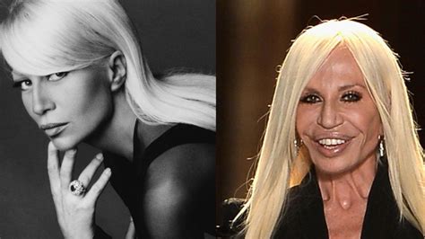 villa versace donatella|donatella versace before and after surgery.